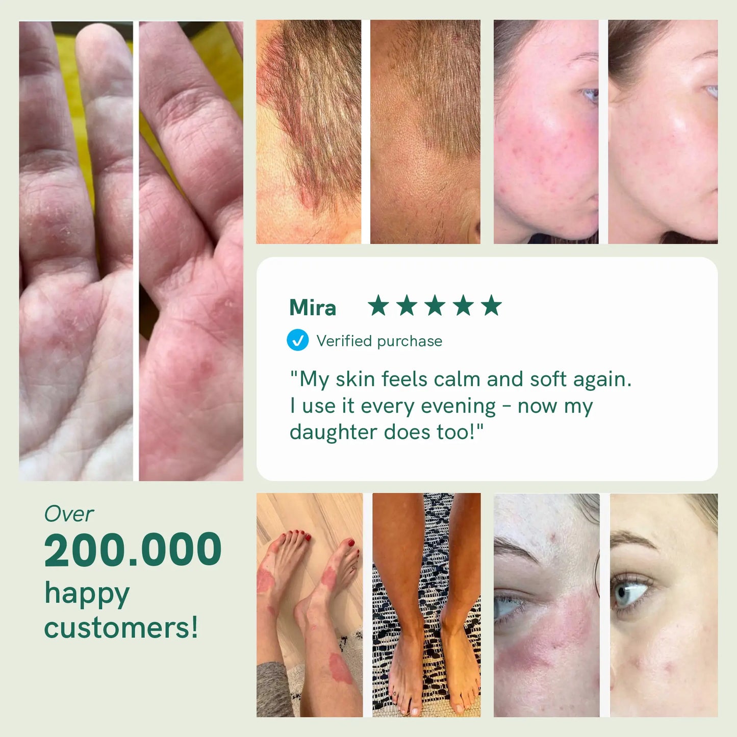 CBD Cream