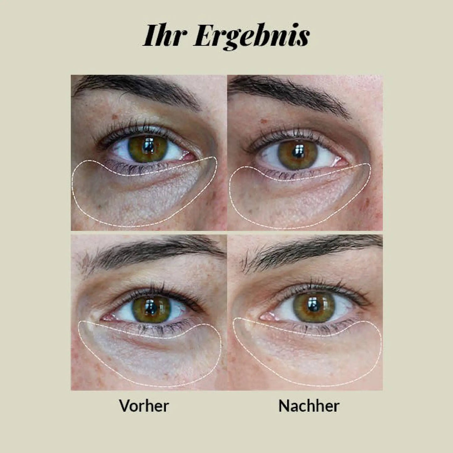 CBD Eye Cream - Hyaluronic Acid